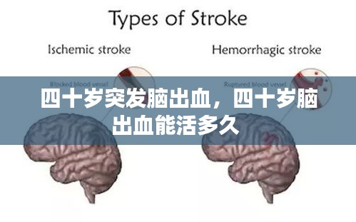 四十岁突发脑出血，四十岁脑出血能活多久 