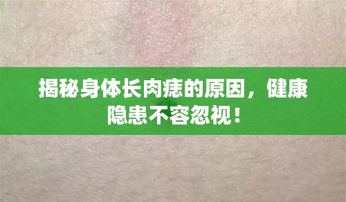 揭秘身体长肉痣的原因，健康隐患不容忽视！